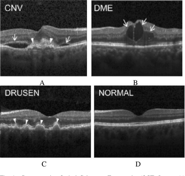 Figure 1 for Demystifying Deep Learning Models for Retinal OCT Disease Classification using Explainable AI