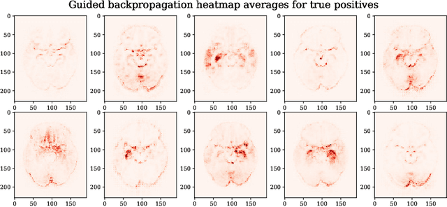 Figure 1 for Testing the robustness of attribution methods for convolutional neural networks in MRI-based Alzheimer's disease classification