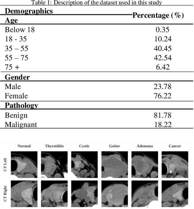 Figure 2 for Multi-channel deep convolutional neural networks for multi-classifying thyroid disease