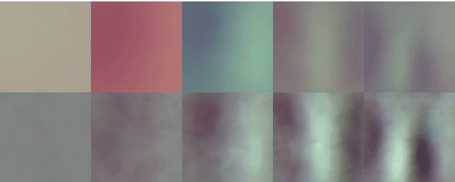 Figure 3 for Joint segmentation and classification of retinal arteries/veins from fundus images