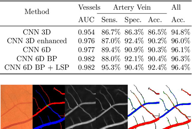 Figure 4 for Joint segmentation and classification of retinal arteries/veins from fundus images