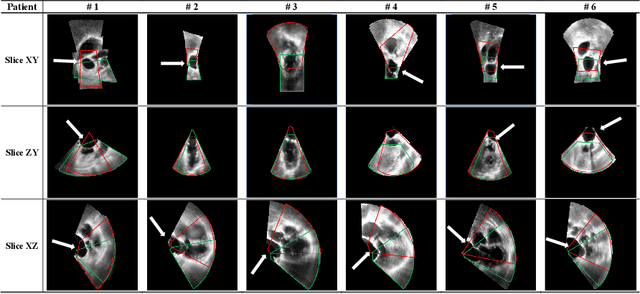 Figure 4 for Direct Simultaneous Multi-Image Registration