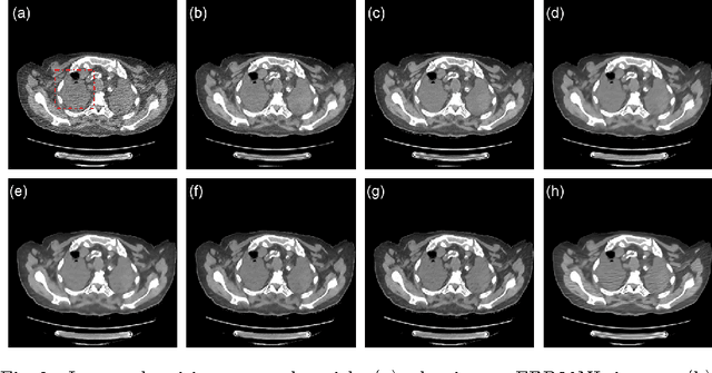 Figure 3 for CT Image Denoising with Perceptive Deep Neural Networks