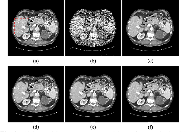 Figure 1 for Sparse-View CT Reconstruction via Convolutional Sparse Coding