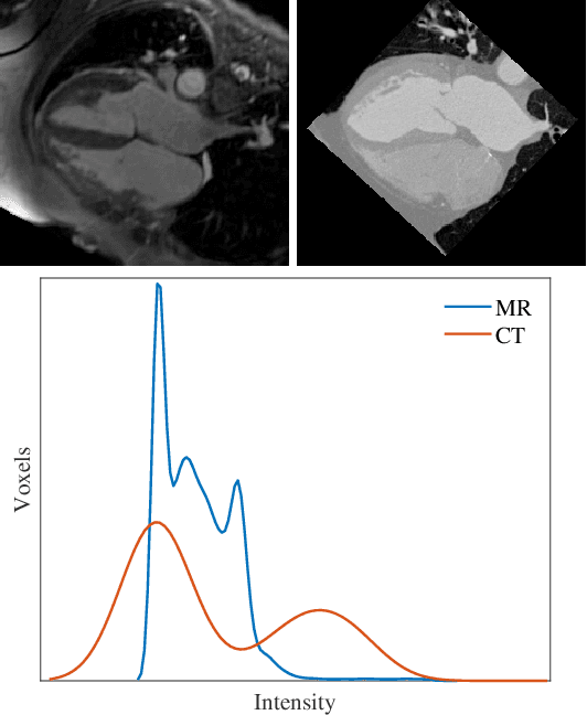 Figure 1 for SGDR: Semantic-guided Disentangled Representation for Unsupervised Cross-modality Medical Image Segmentation