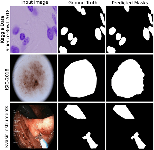 Figure 3 for PAANet: Progressive Alternating Attention for Automatic Medical Image Segmentation
