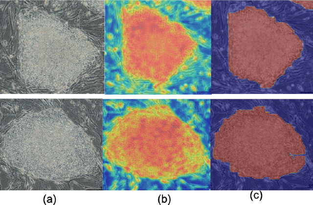 Figure 4 for Attention-effective multiple instance learning on weakly stem cell colony segmentation