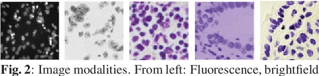 Figure 3 for Mask-RCNN and U-net Ensembled for Nuclei Segmentation