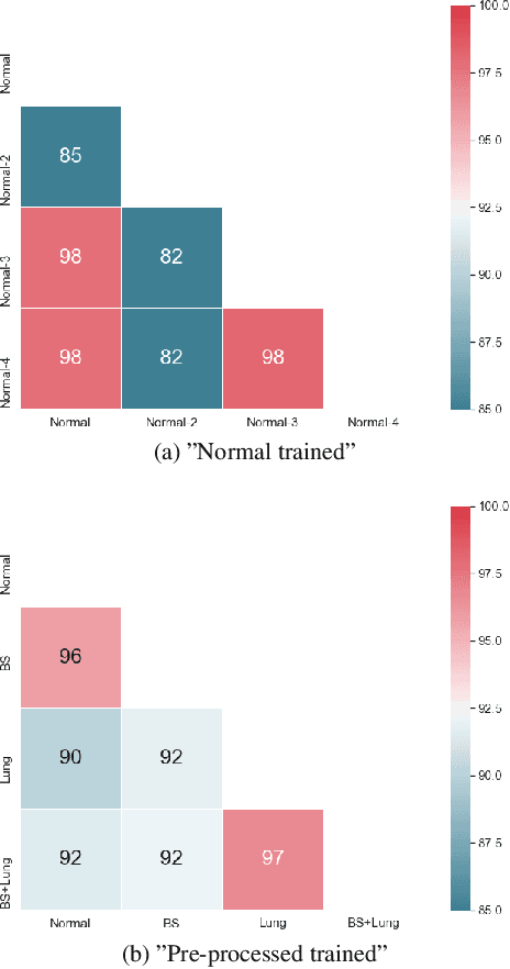 Figure 4 for When does Bone Suppression and Lung Field Segmentation Improve Chest X-Ray Disease Classification?