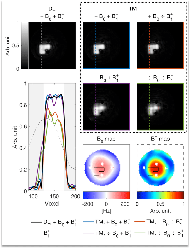 Figure 2 for DeepControl: 2D RF pulses facilitating $B_1^+$ inhomogeneity and $B_0$ off-resonance compensation in vivo at 7T