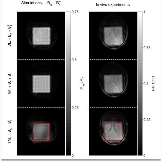 Figure 3 for DeepControl: 2D RF pulses facilitating $B_1^+$ inhomogeneity and $B_0$ off-resonance compensation in vivo at 7T