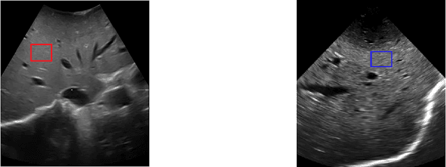 Figure 3 for Unsupervised Despeckling