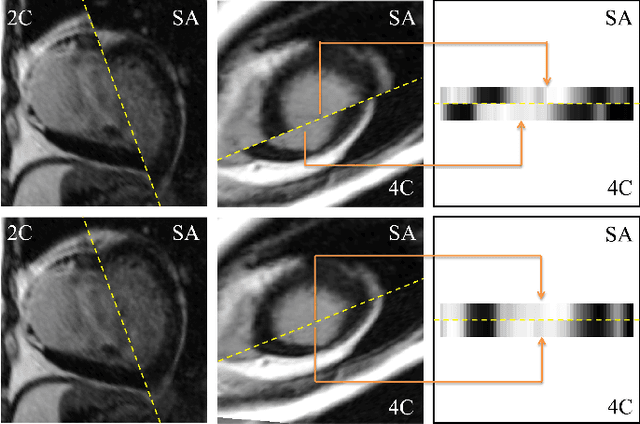 Figure 2 for A Comprehensive 3-D Framework for Automatic Quantification of Late Gadolinium Enhanced Cardiac Magnetic Resonance Images