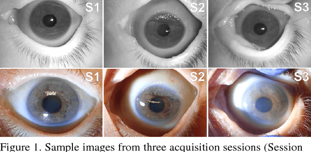 Figure 1 for Post-mortem Human Iris Recognition