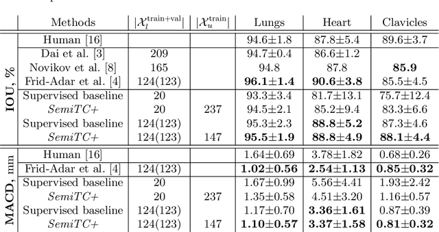 Figure 3 for Semi-Supervised Medical Image Segmentation via Learning Consistency under Transformations