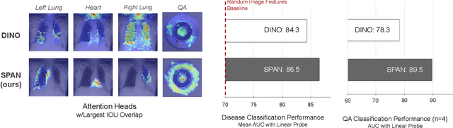 Figure 1 for Prior Knowledge-Guided Attention in Self-Supervised Vision Transformers