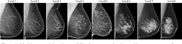 Figure 1 for CSAW-M: An Ordinal Classification Dataset for Benchmarking Mammographic Masking of Cancer