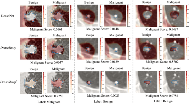 Figure 4 for Probabilistic Radiomics: Ambiguous Diagnosis with Controllable Shape Analysis