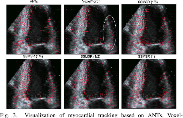 Figure 3 for Test-Time Training for Deformable Multi-Scale Image Registration