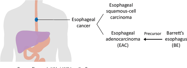 Figure 4 for Ranking and Selection with Covariates for Personalized Decision Making