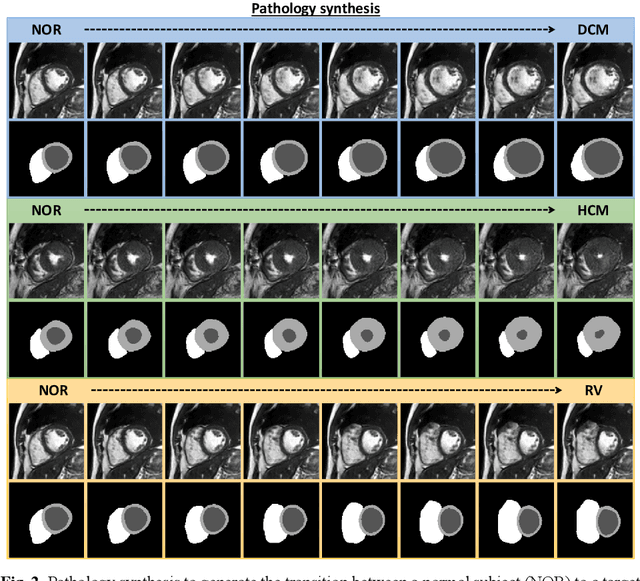 Figure 2 for Pathology Synthesis of 3D Consistent Cardiac MR Im-ages Using 2D VAEs and GANs