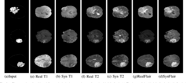 Figure 2 for Modality Bank: Learn multi-modality images across data centers without sharing medical data