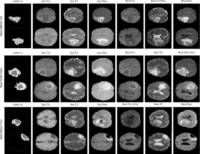 Figure 3 for Modality Bank: Learn multi-modality images across data centers without sharing medical data