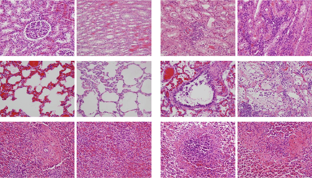 Figure 4 for Signal Classification under structure sparsity constraints