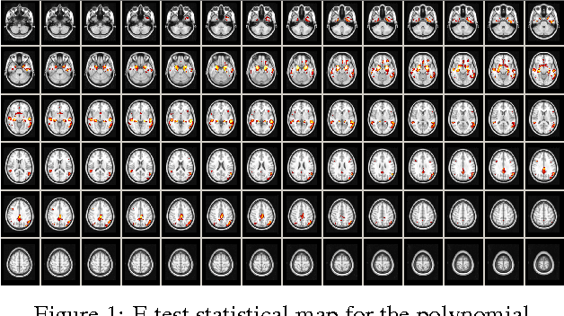 Figure 1 for Voxelwise nonlinear regression toolbox for neuroimage analysis: Application to aging and neurodegenerative disease modeling