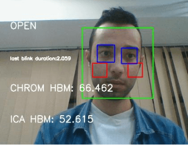 Figure 4 for Using image-extracted features to determine heart rate and blink duration for driver sleepiness detection