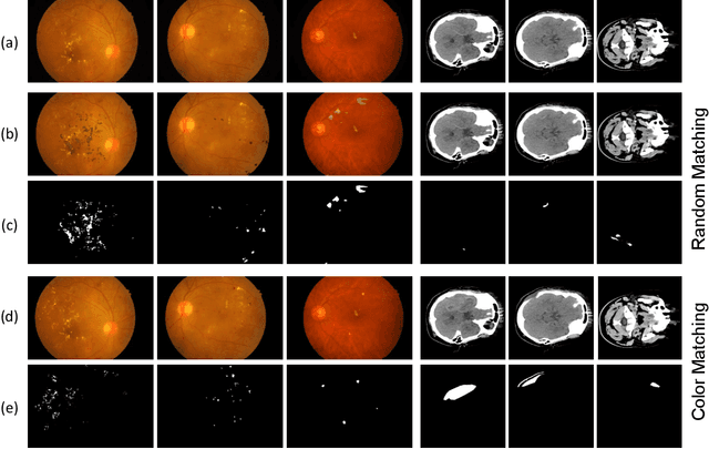 Figure 3 for Cut-Paste Consistency Learning for Semi-Supervised Lesion Segmentation
