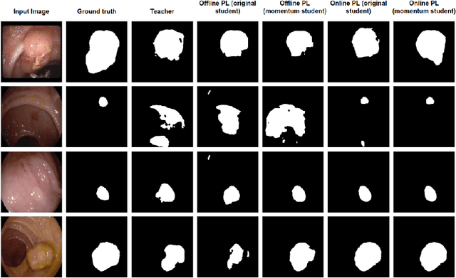 Figure 2 for Online pseudo labeling for polyp segmentation with momentum networks