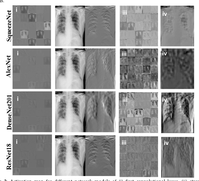 Figure 2 for Can AI help in screening Viral and COVID-19 pneumonia?