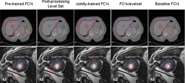 Figure 4 for A deep level set method for image segmentation