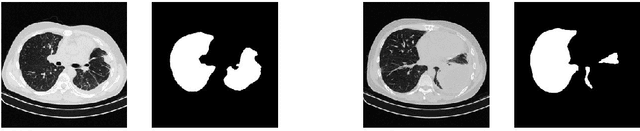 Figure 4 for CoRSAI: A System for Robust Interpretation of CT Scans of COVID-19 Patients Using Deep Learning