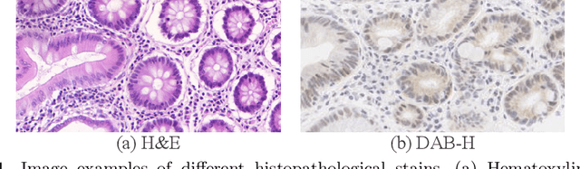 Figure 1 for Dual Adaptive Pyramid Network for Cross-Stain Histopathology Image Segmentation