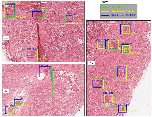 Figure 2 for On Smart Gaze based Annotation of Histopathology Images for Training of Deep Convolutional Neural Networks