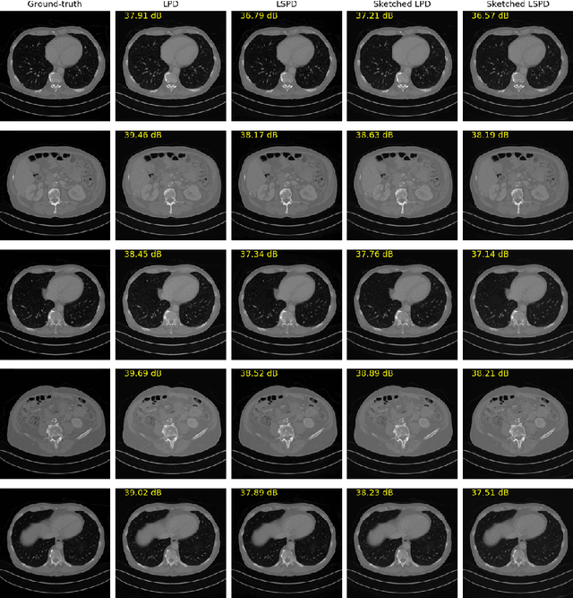 Figure 1 for Operator Sketching for Deep Unrolling Networks