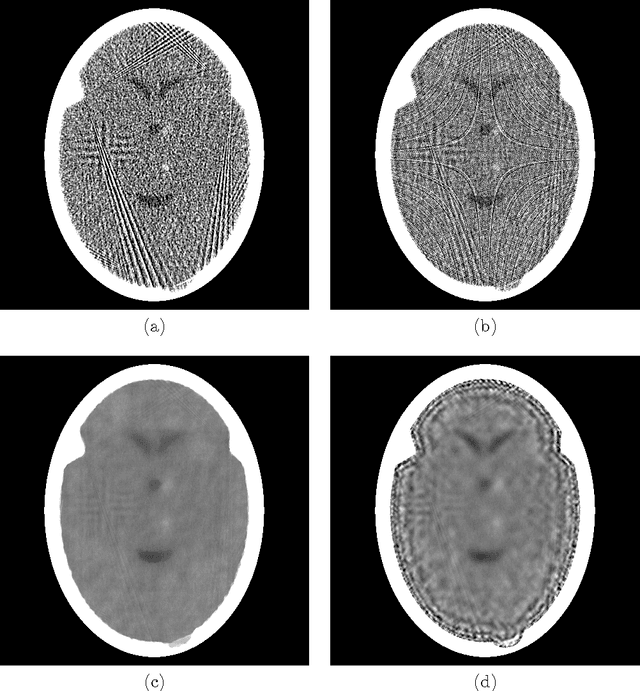 Figure 3 for Computerized Tomography with Total Variation and with Shearlets