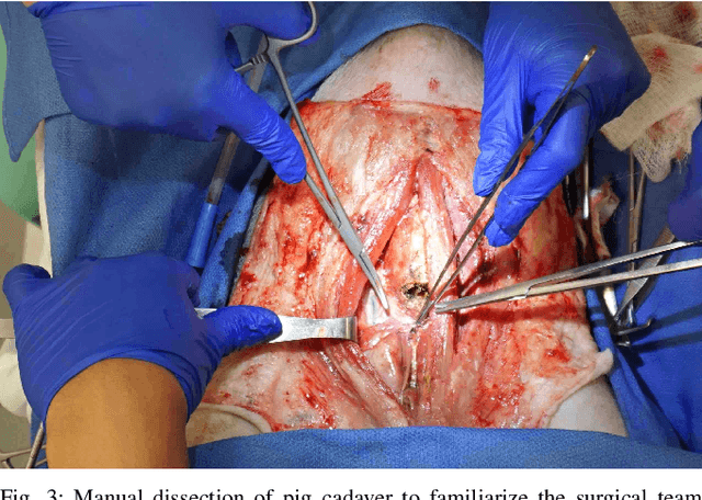 Figure 3 for From Bench to Bedside: The First Live Robotic Surgery on the dVRK to Enable Remote Telesurgery with Motion Scaling