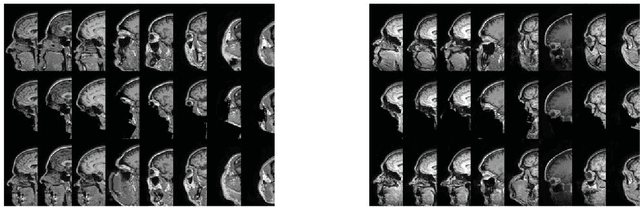 Figure 3 for Refacing: reconstructing anonymized facial features using GANs