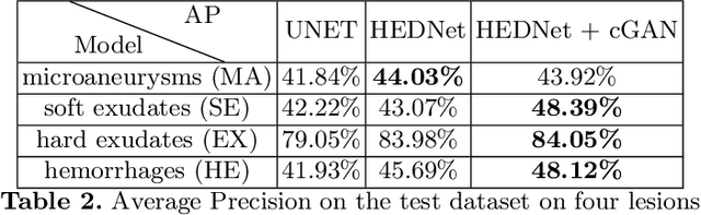 Figure 4 for Improving Lesion Segmentation for Diabetic Retinopathy using Adversarial Learning