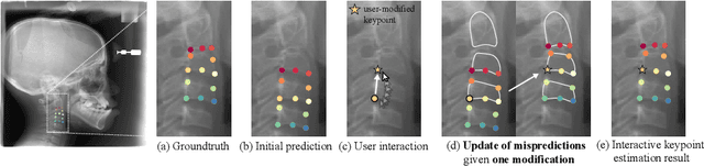 Figure 1 for Morphology-Aware Interactive Keypoint Estimation