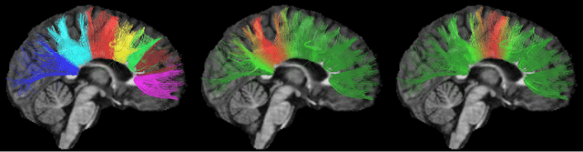 Figure 1 for White matter fiber analysis using kernel dictionary learning and sparsity priors
