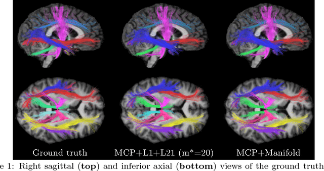 Figure 3 for White matter fiber analysis using kernel dictionary learning and sparsity priors