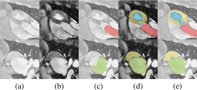 Figure 1 for Self-Attentive Spatial Adaptive Normalization for Cross-Modality Domain Adaptation