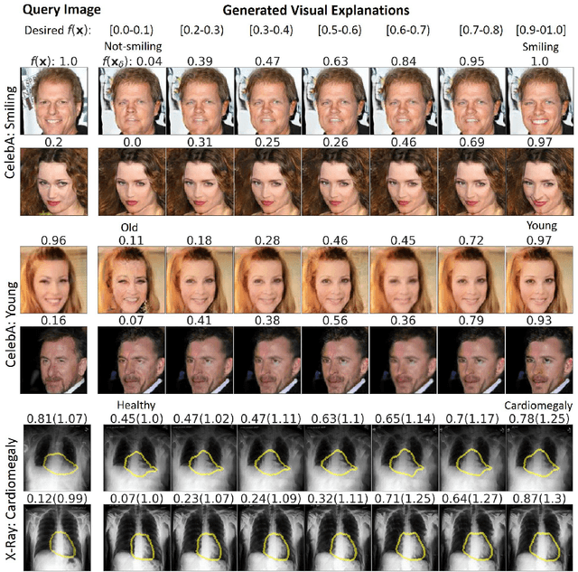 Figure 3 for Explanation by Progressive Exaggeration