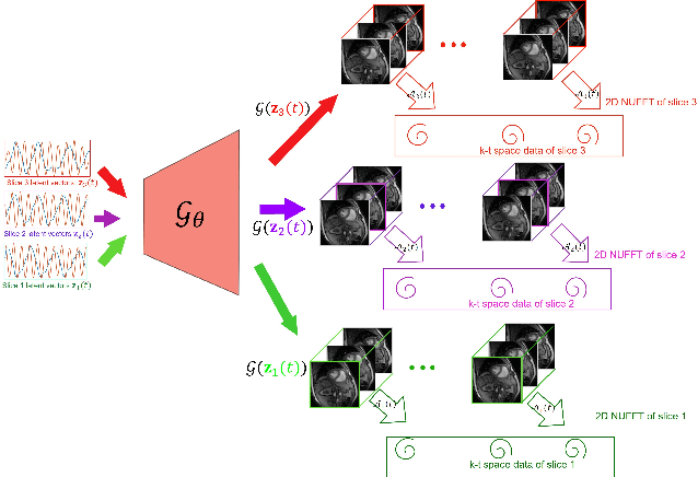 Figure 1 for Alignment & joint recovery of multi-slice dynamic MRI using deep generative manifold model