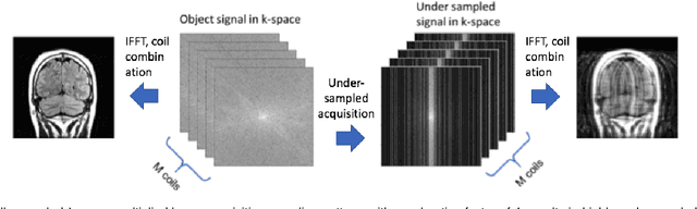 Figure 1 for Adaptive Gradient Balancing for UndersampledMRI Reconstruction and Image-to-Image Translation