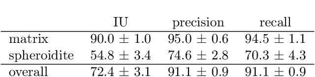 Figure 4 for High throughput quantitative metallography for complex microstructures using deep learning: A case study in ultrahigh carbon steel
